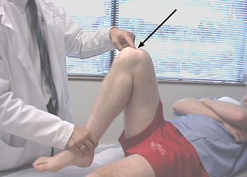 Bolest v kolenech během flexe je nejčastějším důvodem, proč lidé navštěvují traumatické lékaře. 