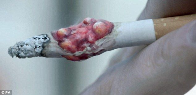 Ve Velké Británii začaly hrozné anti-reklamní cigarety