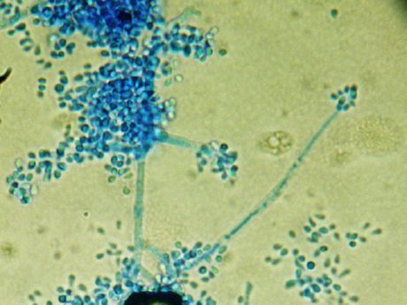 Příčinný faktor favus (Trichophyton schoenleinii)